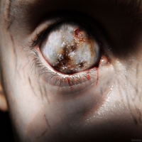 Искусство - перейти на эту картинку гнилой глаз